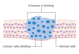 cancer cell developing