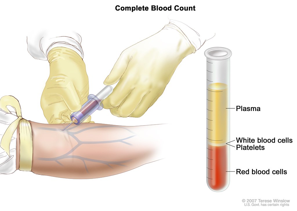 blood test